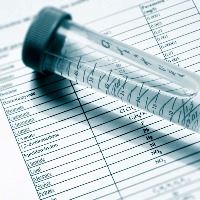 Picture of a water test.